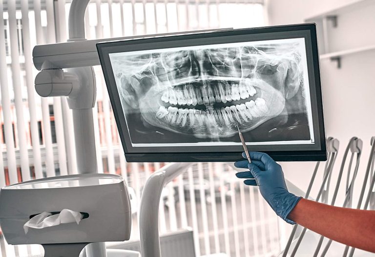 Dentist reviewing a panoramic dental X-ray on a screen